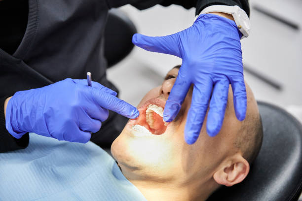 Best Knocked-Out Tooth (Avulsed Tooth) Treatment in Cedarhurst, NY